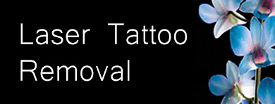 Laser Tattoo Removal